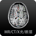 影像学图谱app