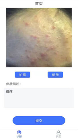 扫一扫查皮肤病的app(皮肤病诊断选药)